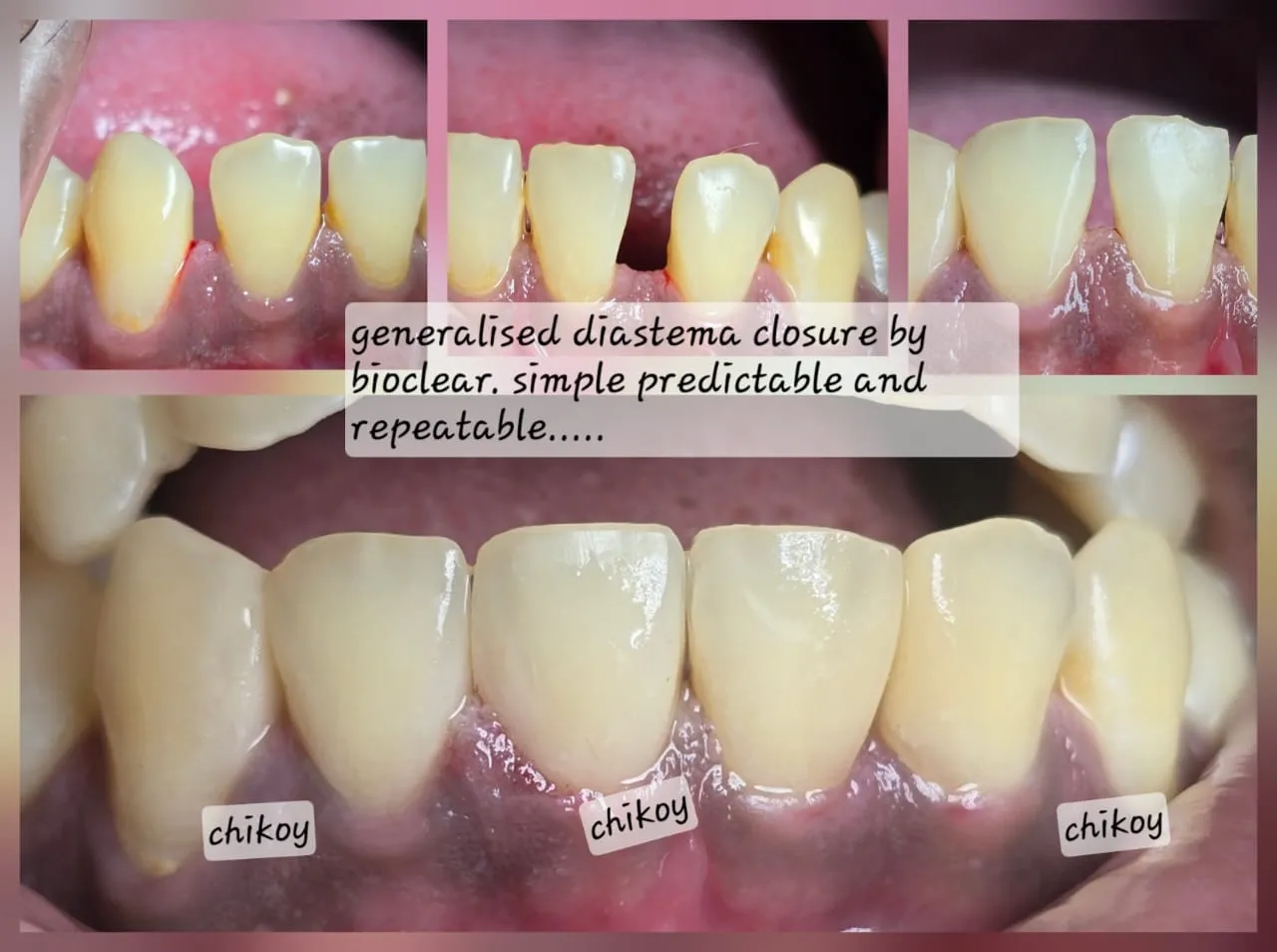 Expert Dentist