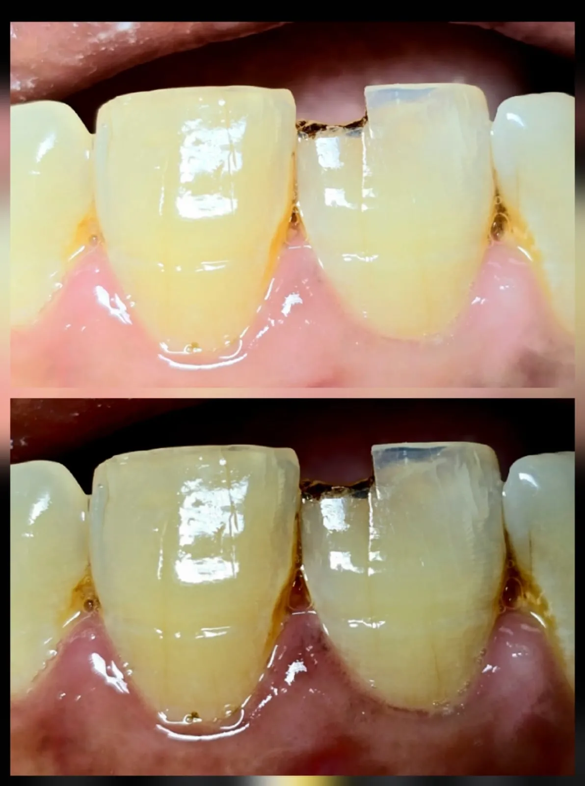 Expert Dentist