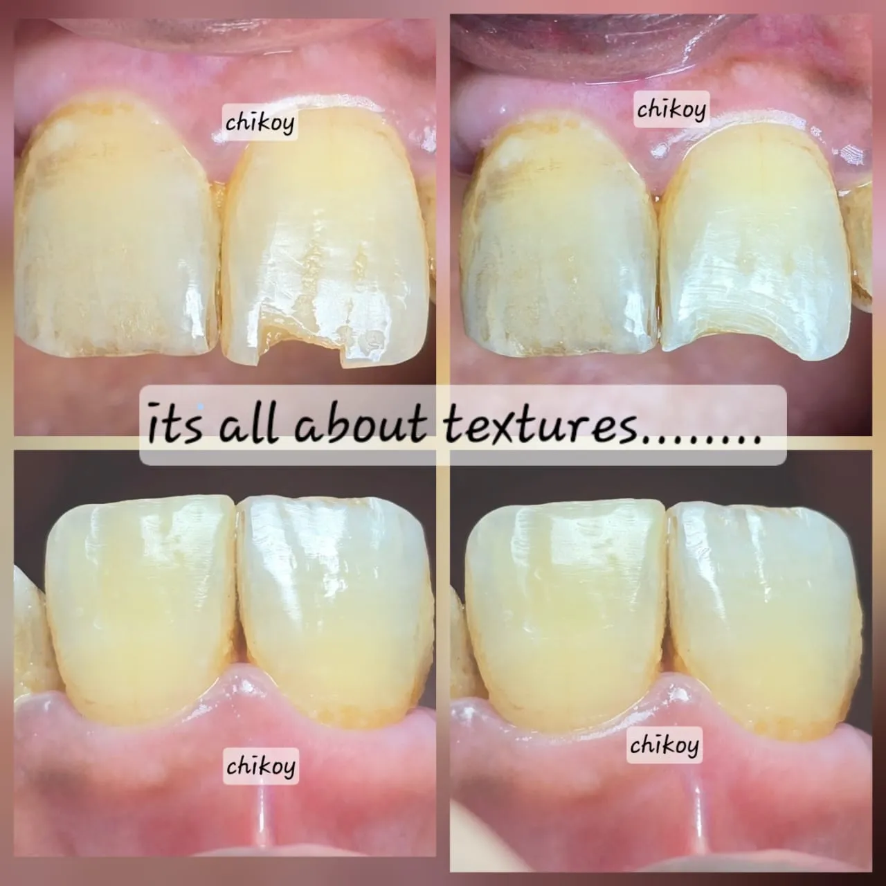 Expert Dentist
