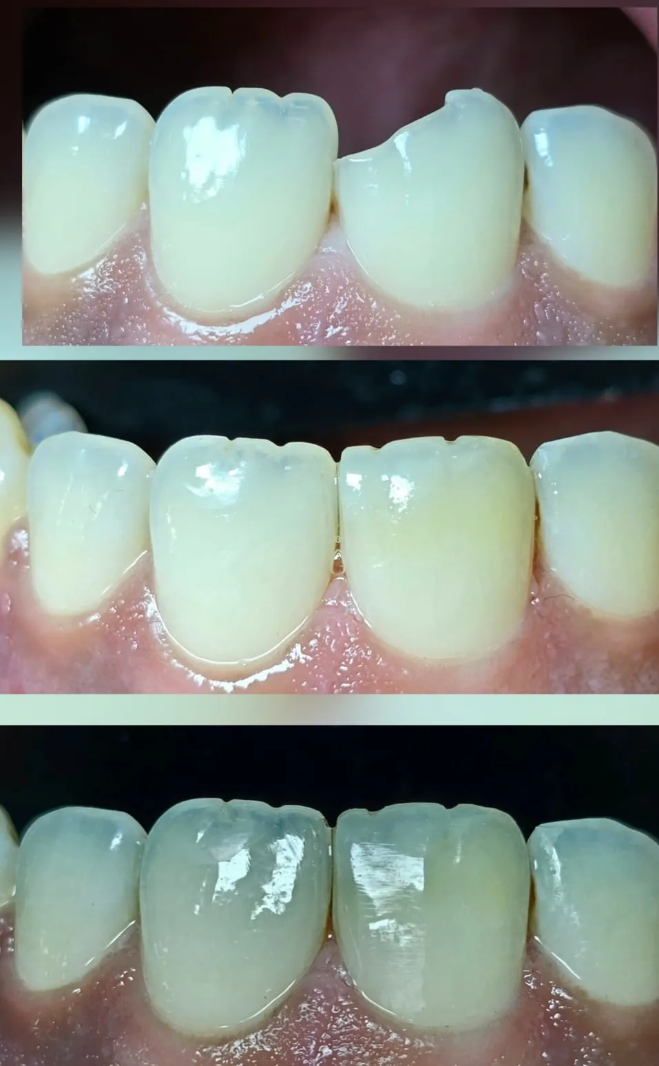 Expert Dentist